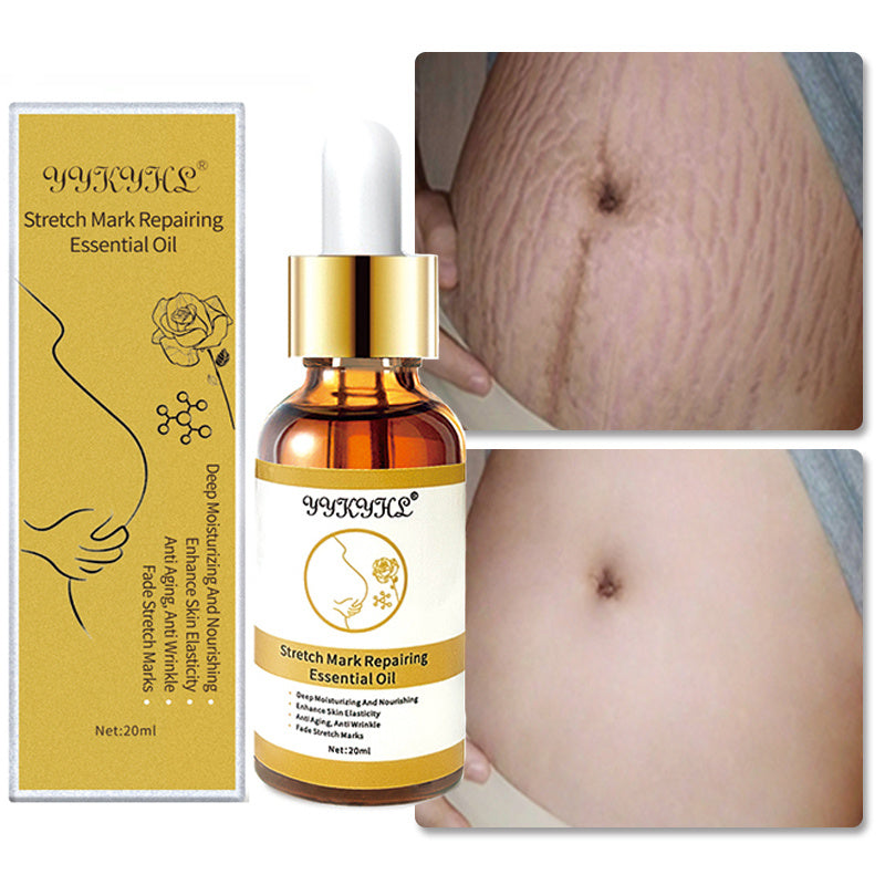 Stretch Mark Repair Body Oil