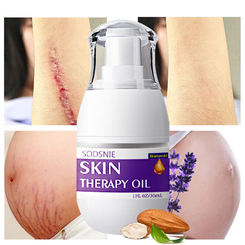 Cellulite and Stretch Mark Repair